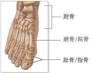 拇外翻的症状及治疗方法.jpg