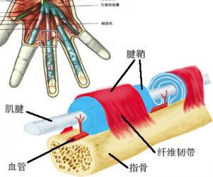 腱鞘炎不及时治疗可发展成一直活动不便.jpg
