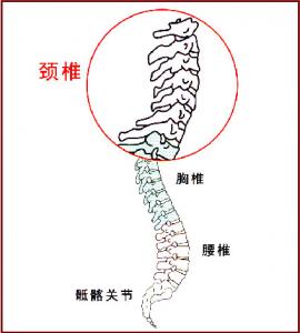 颈椎病的症状有哪些.jpg