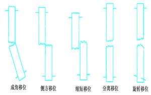 骨折的分类及诊断方法.jpg